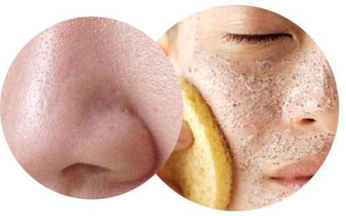 thuốc đặc trị viêm nang lông