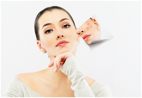 kem dưỡng ẩm cho da mụn