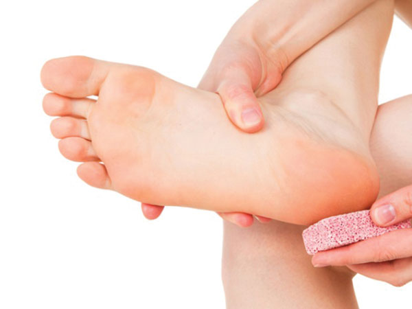 Trị nứt gót chân