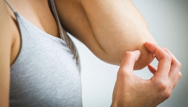 bệnh viêm lỗ chân lông