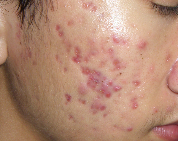 cách sử dụng serum dưỡng da