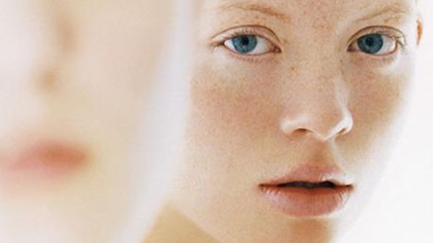 kem trị nám da hiệu quả