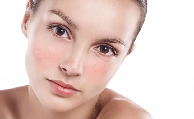 giãn mao mạch ở mũi