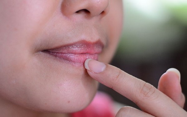 serum trị thâm môi