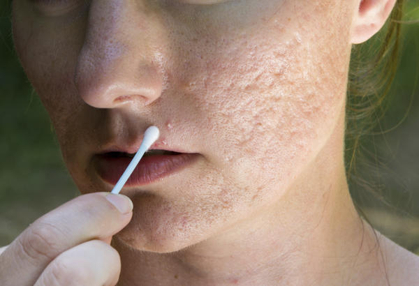 serum trị sẹo rỗ