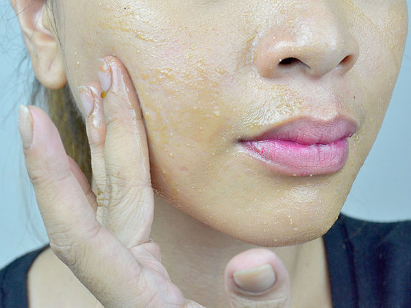 tự tẩy da chết