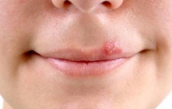 Kem dưỡng da chống nắng Kem dưỡng da chống nắng