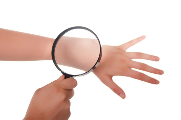 chăm sóc da cháy nắng chăm sóc da cháy nắng