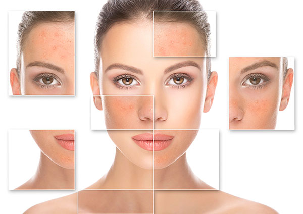 chăm sóc da kích ứng chăm sóc da kích ứng