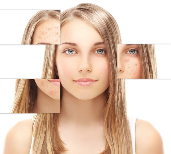 nhận biết tình trạng da