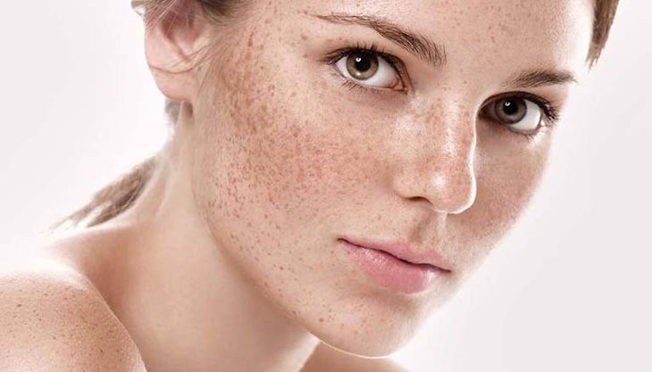 giải đáp những thắc mắc chi tiết về kem chống nắng cho da nám