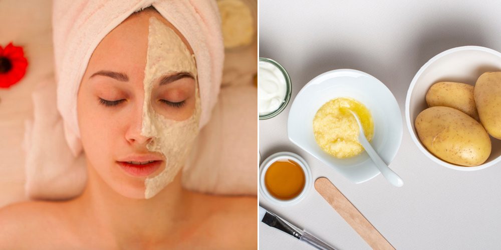 Vậy có phải chỉ cần đắp mặt nạ trị nám bằng khoai tây và sữa tươi thường xuyên là có thể đạt được làn da sáng mịn như mong đợi?