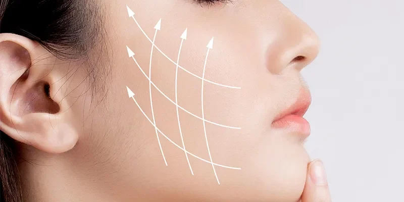 Quy trình căng chỉ da mặt chống lão hóa hiệu quả