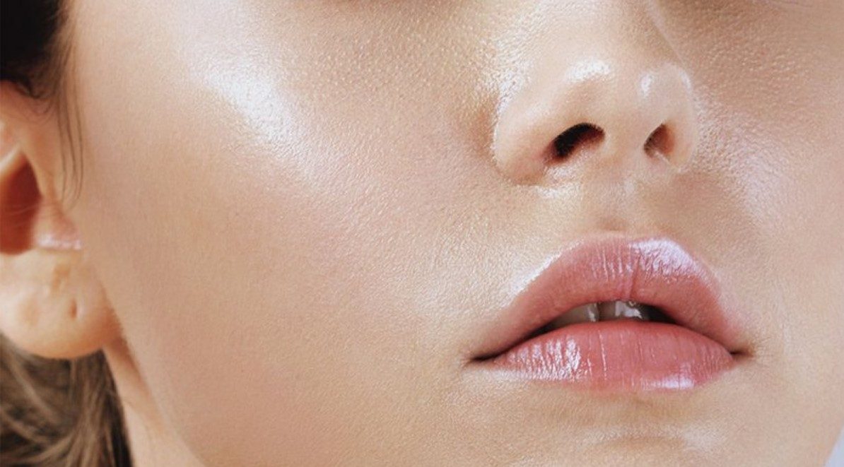 Hiểu rõ nguyên nhân để có cách chăm sóc da dầu dễ nổi mụn vào mùa hè