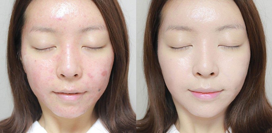 Sau khi chọn cushion cho da dầu lỗ chân lông to đúng, sử dụng làm sao cho hiệu quả