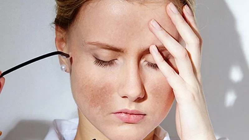 Tìm hiểu nguyên nhân vì sao da dầu bị sạm màu