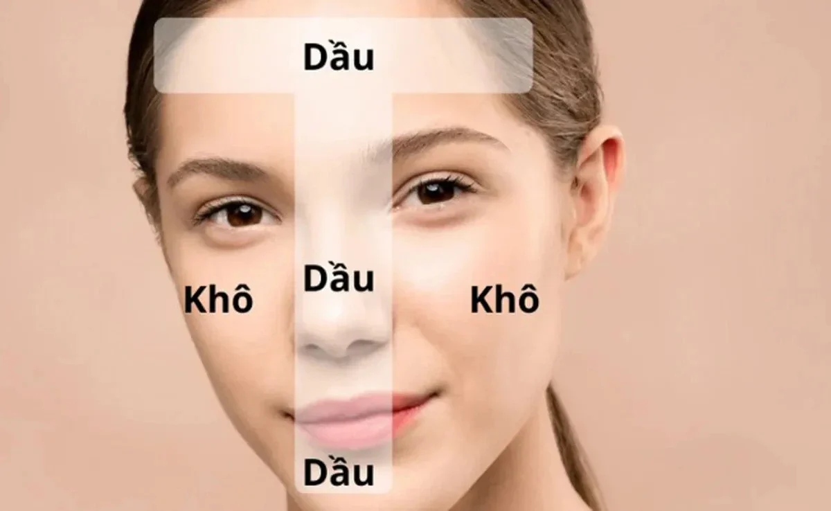 Da hỗn hợp khác gì da dầu? Phân biệt đặc điểm của hai loại da