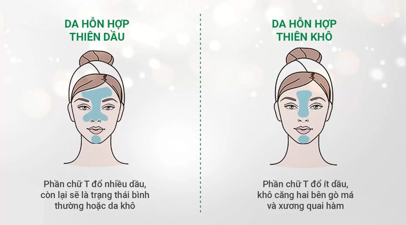 Da hỗn hợp khác gì da dầu, Những lưu ý khi chăm sóc hai làn da này