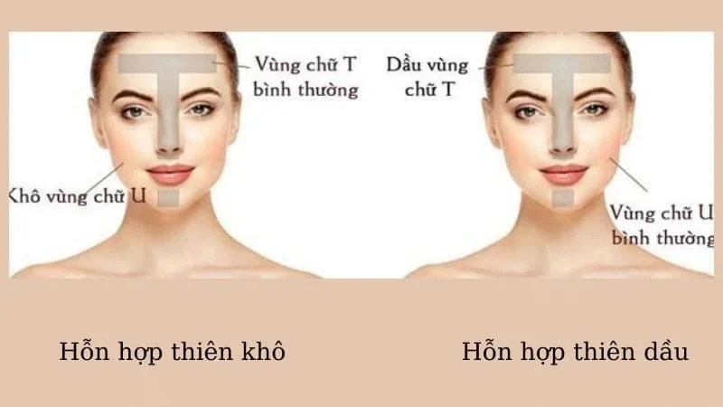 Dấu hiệu nhận biết và đặc điểm của da hỗn hợp thiên dầu