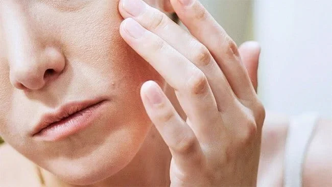 Tìm hiểu đặc điểm và nguyên nhân của da hỗn hợp thiên khô