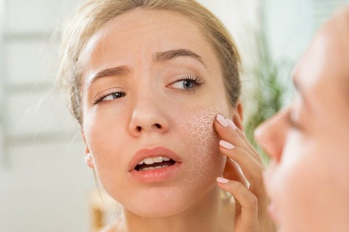 Cách chăm sóc da khô do dùng thuốc giúp phục hồi da nhanh chóng