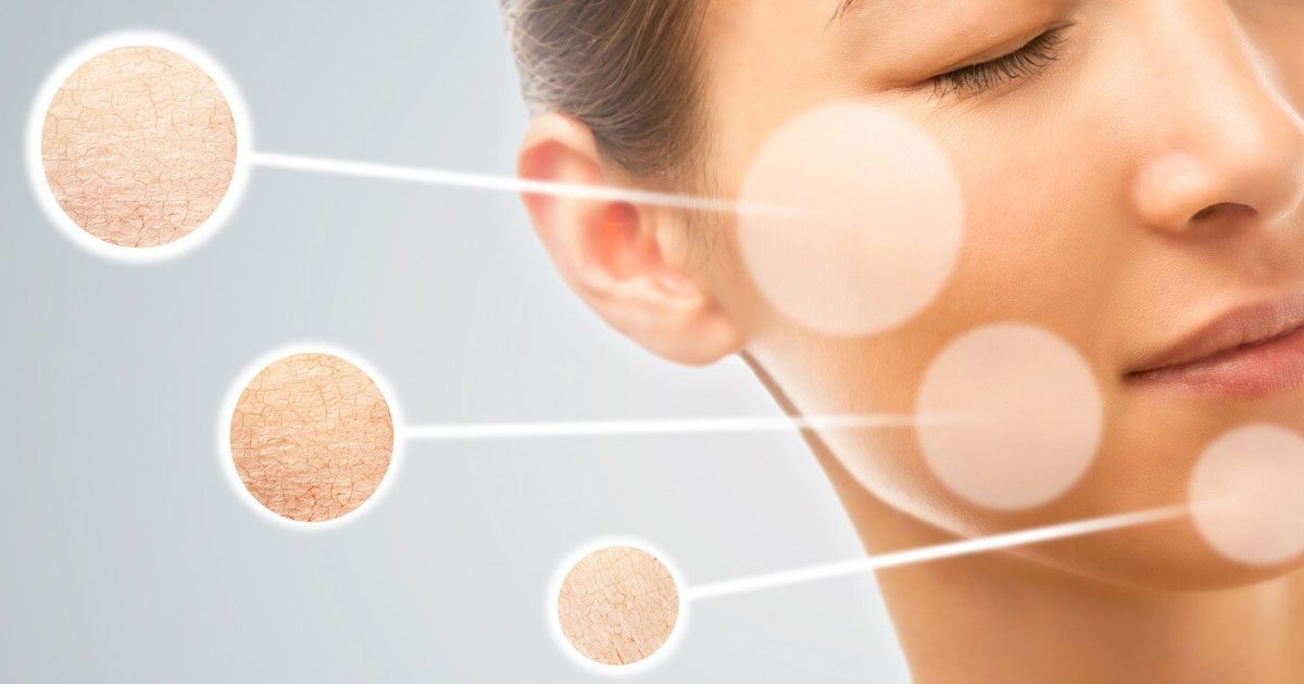 Nhận biết dấu hiệu da khô do uống ít nước