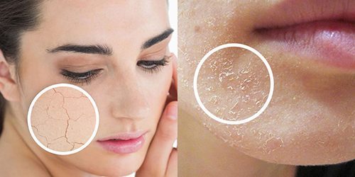 Những phương pháp chăm sóc da khô ở người già phổ biến hiện nay