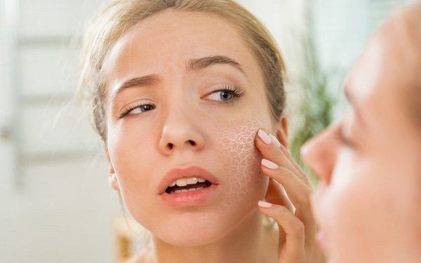 Phục hồi da khô ở phụ nữ sau sinh từ bên trong