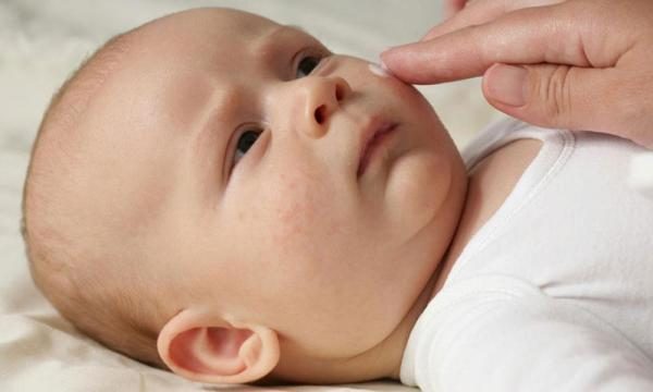 Chăm sóc da khô ở trẻ sơ sinh tại nhà