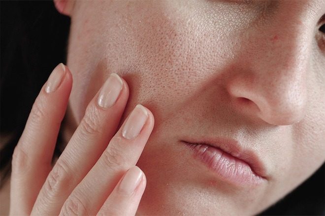 Liệu pháp chăm sóc da khô và lỗ chân lông to