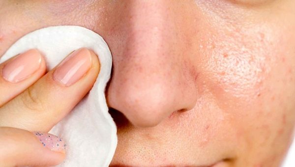 Lưu ý khi chăm sóc da mặt sần sùi lỗ chân lông to