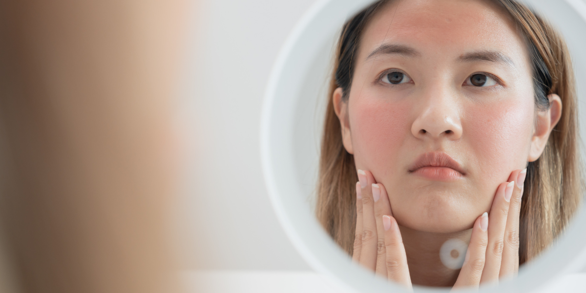 Kem dưỡng ẩm cho bà bầu da khô giúp chăm sóc làn da bà bầu khỏi khô ráp