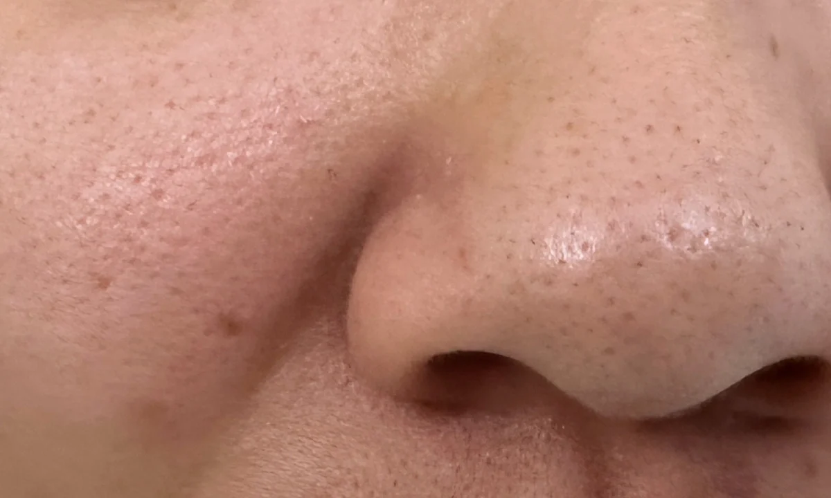 Hiểu đúng về làn da để chọn kem dưỡng ẩm cho da dầu lỗ chân lông to