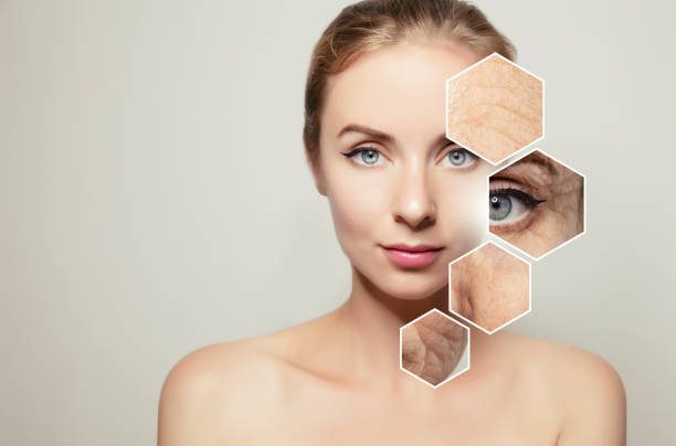Giải đáp những thắc mắc về lăn kim chống lão hóa da