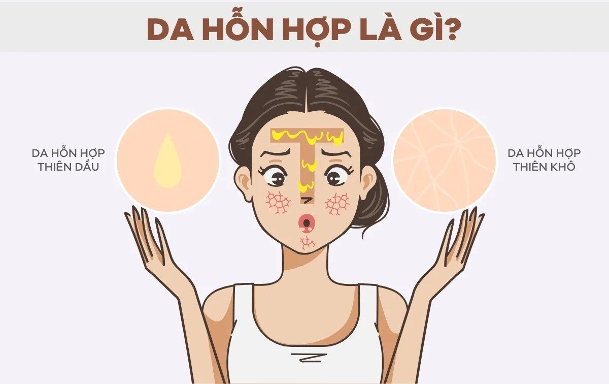 Tìm hiểu nguyên nhân da hỗn hợp