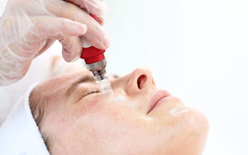 Phi kim trị lão hóa da là gì? Hoạt động ra sao