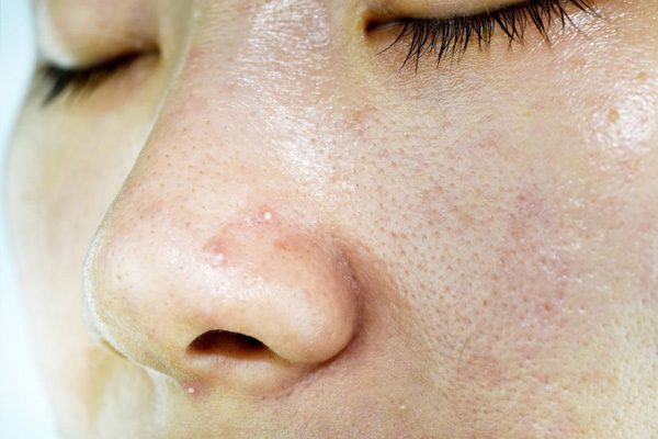 Tiêu chí lựa chọn sản phẩm skincare drugstore cho da dầu hiệu quả