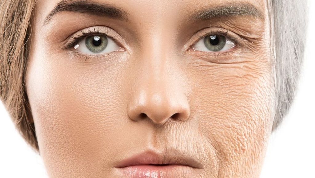 Stress gây lão hóa sớm không