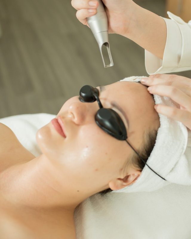 Những lưu ý khi thực hiện trẻ hóa bằng laser