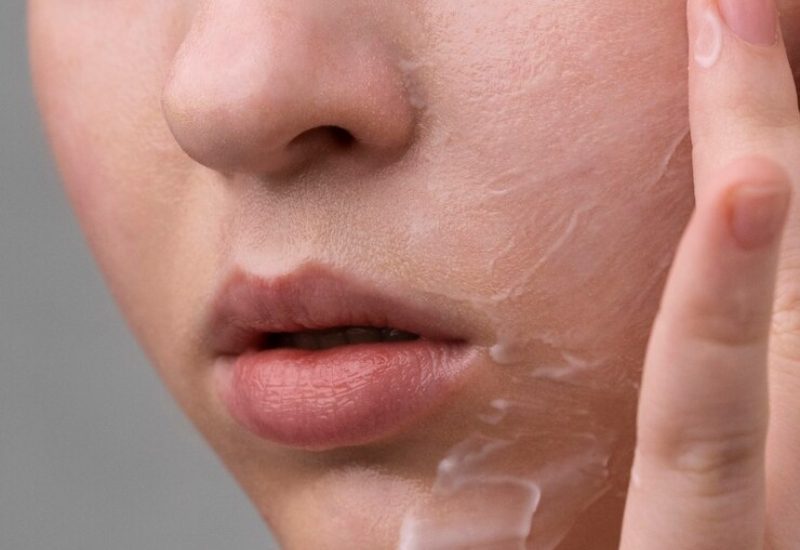 Những trường hợp không nên sử dụng adapalene