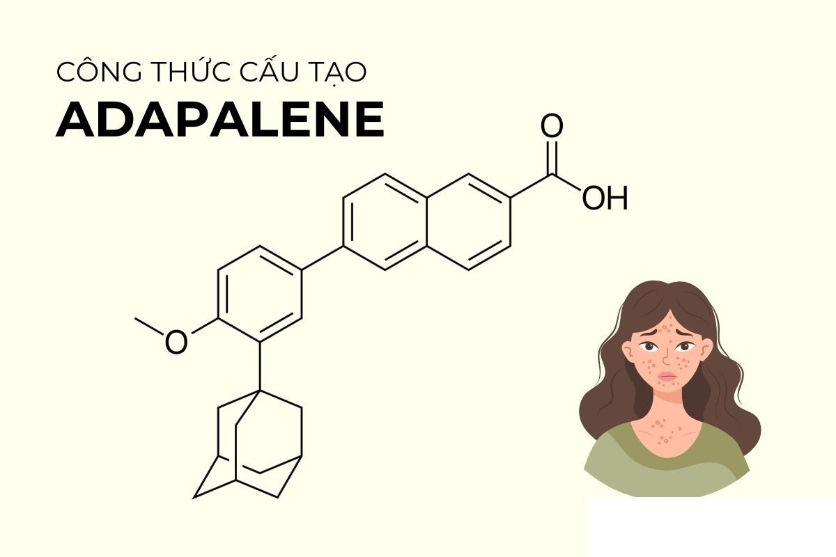Adapalene là gì? Liệu adapalene có phù hợp với mọi loại da, kể cả da nhạy cảm?