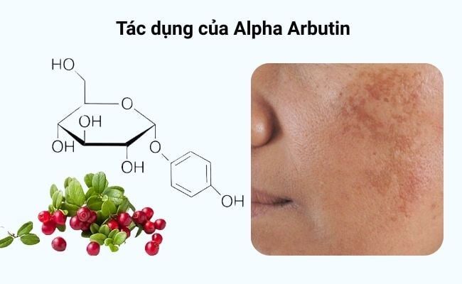 Sử dụng alpha arbutin như thế nào để phát huy hết tiềm năng của nó mà không làm tổn thương đến cấu trúc da?