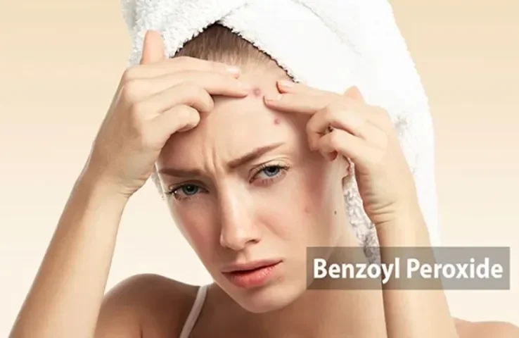 Benzoyl Peroxide thường xuất hiện trong các sản phẩm dành cho da mụn