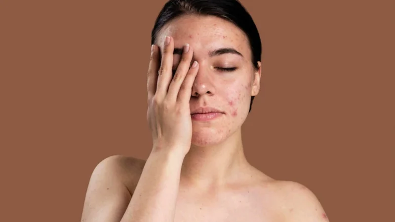 Giới thiệu thương hiệu Dr-Spiller – Chuyên gia chăm sóc và điều trị da nhạy cảm