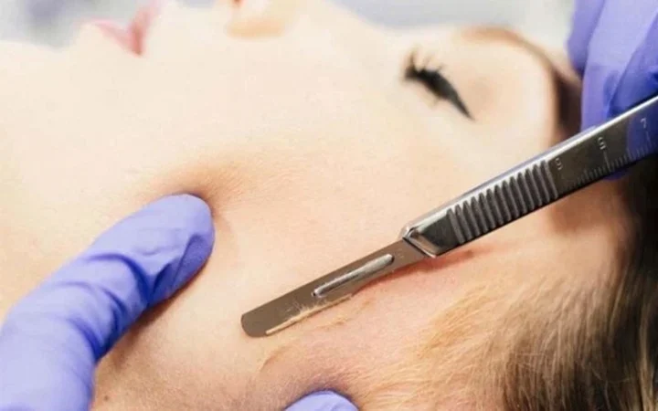 Có nên cạo lông mặt không? Lợi ích và những rủi do khi cạo lông mặt