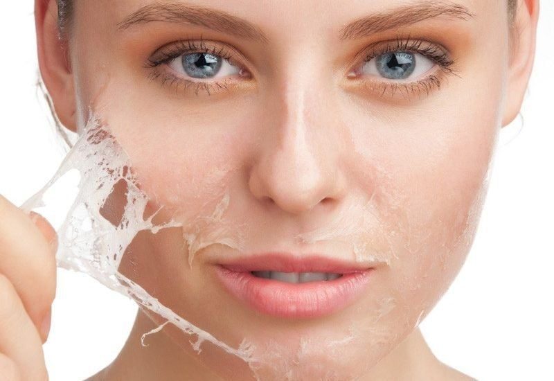 Hướng dẫn peel da mặt an toàn tại nhà
