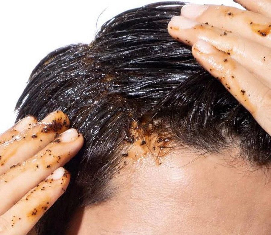 Dấu hiệu cho thấy da đầu bạn cần được tẩy tế bào chết
