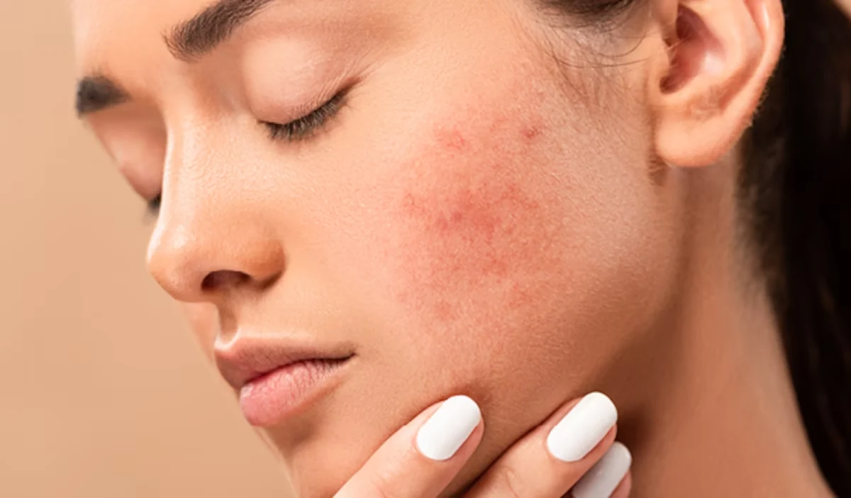 Phương pháp điều trị dị ứng da hiện nay