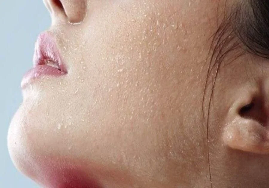 Hiểu rõ nguyên nhân da mặt bị khô để có cách chăm sóc phù hợp