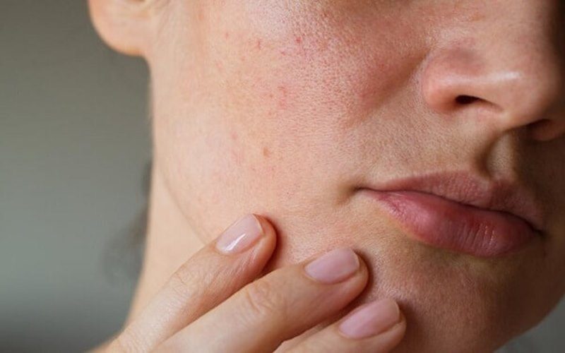 Tìm hiểu nguyên nhân da xỉn màu thiếu sức sống do đâu